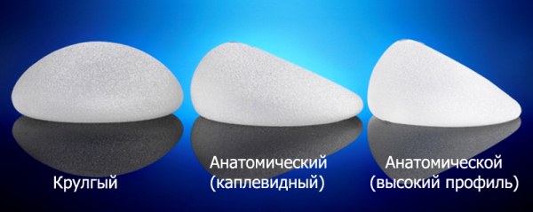 การเสริมหน้าอกด้วยการปลูกถ่ายรูปทรงหยดน้ำในการผ่าตัดเต้านม ภาพถ่ายก่อนและหลัง