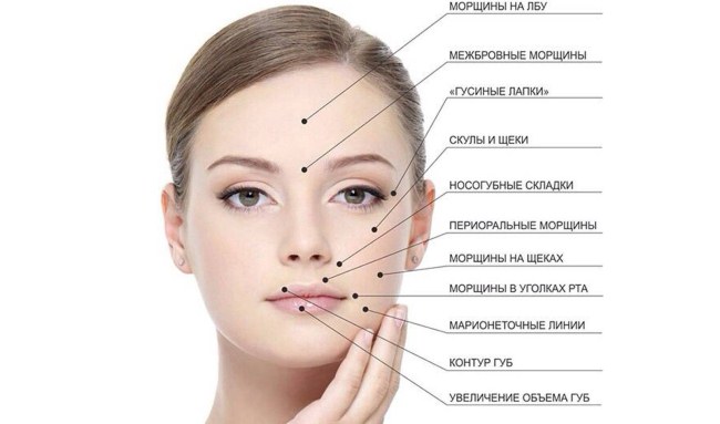 Mésothérapie faciale - qu'est-ce que c'est. Photos avant et après, avis, à quel âge