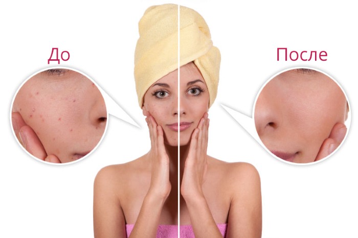 Qu'est-ce que le nettoyage du visage atraumatique