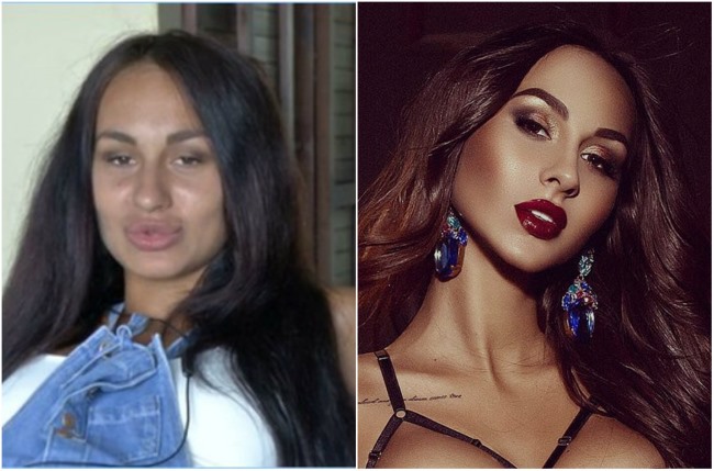 Lera Frost. Photos avant et après chirurgie plastique du nez, des lèvres, des seins