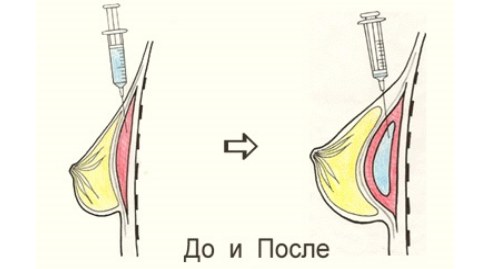Que sont les charges en cosmétologie