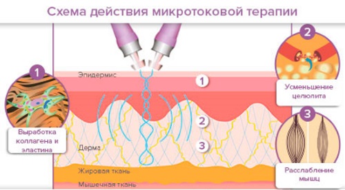 Microcourants pour le visage en cosmétologie - une procédure de thérapie par appareil. Prix, avis