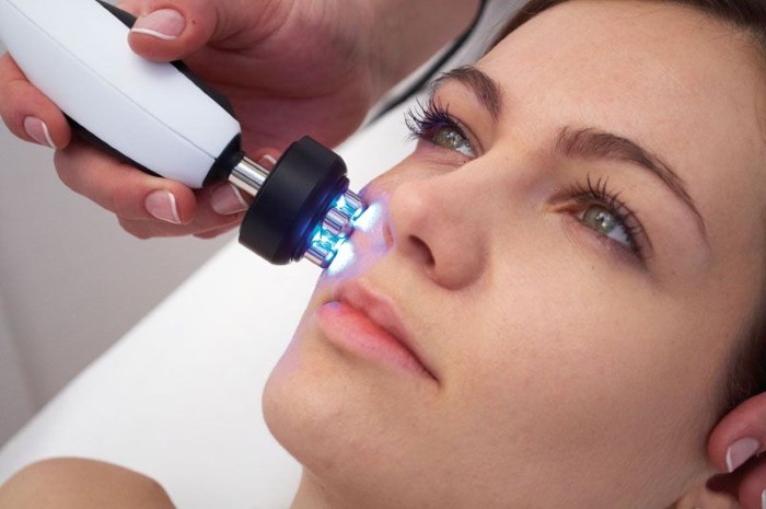 การปรับโฉมรูปไข่ - การยก, ครีมบำรุงผิว, กระทู้, มาสก์, การออกกำลังกายที่บ้าน รูปภาพ