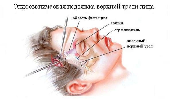 การปรับโฉมรูปไข่ - การยก, ครีมบำรุงผิว, กระทู้, มาสก์, การออกกำลังกายที่บ้าน รูปภาพ