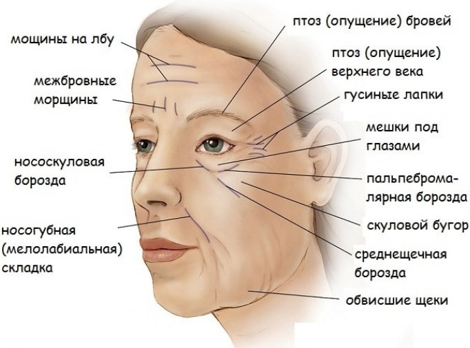 การดึงรูปไข่ - การยก, ครีมบำรุงผิว, กระทู้, มาสก์, การออกกำลังกายที่บ้าน รูปภาพ