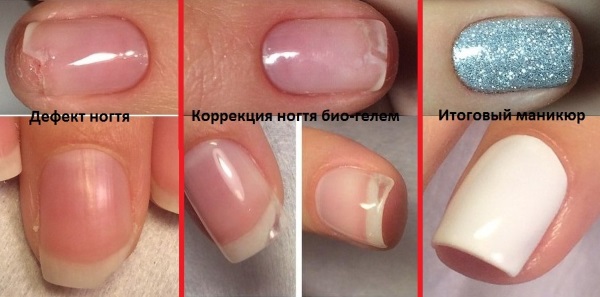 Comment renforcer les ongles avec du gel sous vernis gel.Quels gels sont les meilleurs à utiliser, comment la procédure se déroule étape par étape. Instruction avec photo