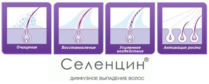 Comprimés pour la croissance des cheveux sur la tête chez les femmes et les hommes. Les meilleures vitamines et médicaments en pharmacie. Avis et prix