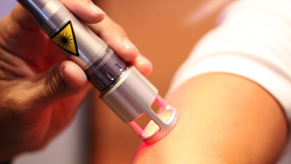 Appareil pour éliminer les taches de vieillesse, les cicatrices, les tatouages sur le visage et la peau du corps. Laser, Fraxel, Elos, M22. Note et avis