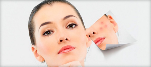 Talker pour l'acné. Recettes avec chloramphénicol, acide salicylique, teinture de calendula, streptocide