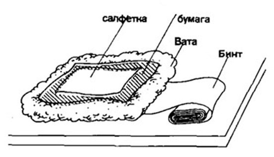 วิธีกำจัดอาการปวดกล้ามเนื้อหลังออกกำลังกายลดด้วยยาขี้ผึ้งยา