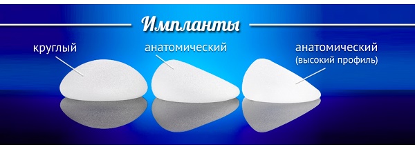 Mastopexie.Comment se déroule l'opération, photos avant et après, sans implants, avec implants, endoprothèses, analyses, conséquences, rééducation, prix