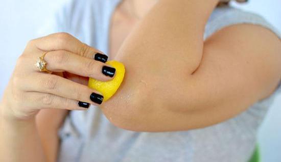 La peau des coudes s'écaille et se fissure, démange. Raisons, photos, remèdes maison, recettes folkloriques, crèmes, onguents en pharmacie