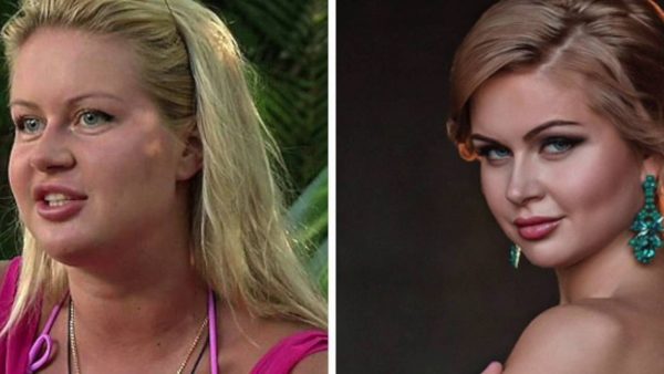 Histoires avant et après la perte de poids. Photos de filles - stars de la Russie: Stepanenko, Chekhov, Gagarine, Kamensky, Afrikantov, Pugachev, Khodchenkov