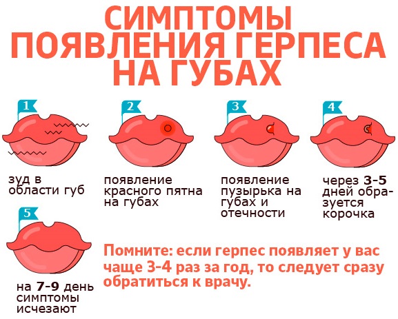 Acide hyaluronique pour les lèvres: photos avant et après, avantages et inconvénients, effet, contre-indications. Prix de la procédure et avis