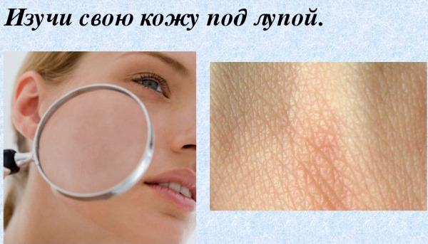 Comment déterminer le type de peau du visage: grasse, sèche, mixte, normale. Caractéristiques de la détermination du phototype Fitzpatrick, du sous-ton, du type de couleur