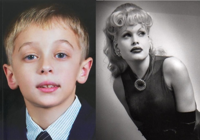 Top 10 des stars de la chirurgie plastique qui n'ont pas réussi. Photos avant et après les acteurs soviétiques, russes, étrangers, hollywoodiens