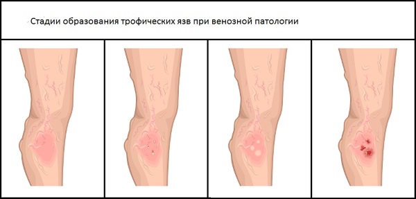 Triderm. Mode d'emploi. Prix, analogues, avis
