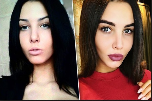 Anastasia Reshetova. Photos avant et après la chirurgie plastique, taille, poids de la fille, paramètres corporels