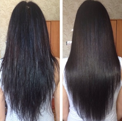 Botox pour les cheveux, les critiques, les conséquences. Quelle est cette procédure, comment est-elle effectuée. Quel Botox est le meilleur, combien ça coûte