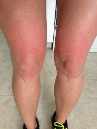 วิธีลดน่องขาสำหรับสาว ๆ การออกกำลังกายที่มีประสิทธิภาพ