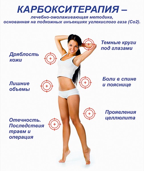 Carboxythérapie - qu'est-ce que c'est pour un visage en cosmétologie: non-injection, non-invasive, injection. Photos avant et après, prix, avis