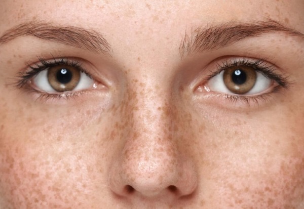 Microneedling: ce que c'est, comment c'est fait. Appareils, contre-indications, prix de la procédure, avis