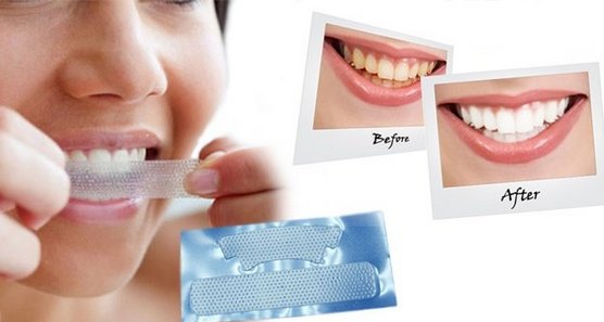Bandes de blanchiment des dents: blanc 3D, mélangez un Med, Crest, Rigel, Advanced dents, Oral Pro, Bright light. Prix en pharmacie