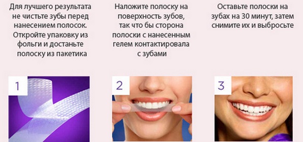 Bandes de blanchiment des dents: blanc 3D, mélangez un Med, Crest, Rigel, Advanced dents, Oral Pro, Bright light. Prix en pharmacie