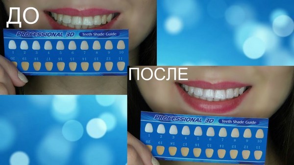 Bandes de blanchiment des dents: blanc 3D, mélangez un Med, Crest, Rigel, Advanced dents, Oral Pro, Bright light. Prix en pharmacie