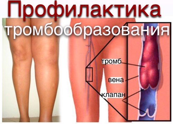 Pressotherapy - มันคืออะไรข้อบ่งชี้ข้อห้ามอุปกรณ์สำหรับการกดที่บ้าน ความคิดเห็นก่อนและหลังภาพถ่าย