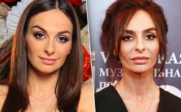 Barnabas Catherine. Photos avant et après la chirurgie plastique, biographie, vie personnelle, carrière, taille, poids, âge, paramètres corporels