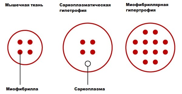 Comment se débarrasser des douleurs musculaires après l'entraînement: onguents, pilules, gels analgésiques, remèdes populaires