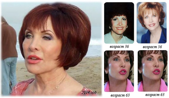 Volé sur le visage: qu'est-ce que c'est, comment l'enlever.Exercice, gymnastique, massage pour resserrer à la maison