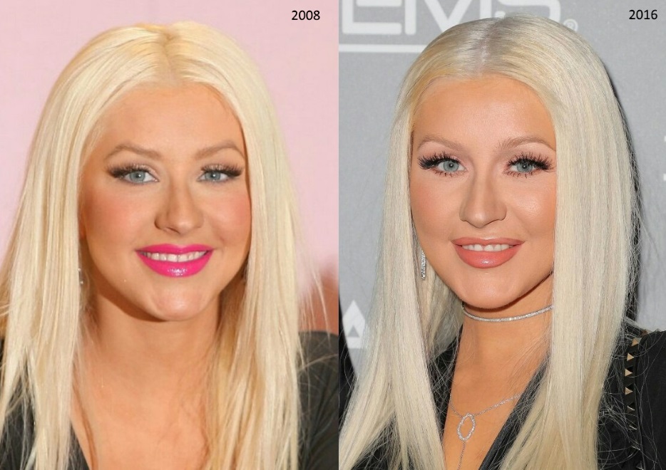 Stars avant et après la chirurgie plastique.Photos russe, hollywoodienne, coréenne, infructueuse, victimes, Instagram, à la maison 2