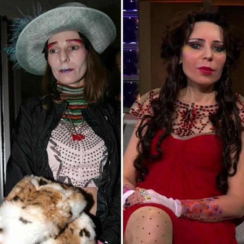 Stars avant et après la chirurgie plastique. Photos russe, hollywoodienne, coréenne, infructueuse, victimes, Instagram, à la maison 2