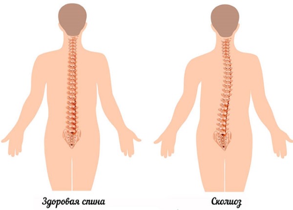 Tirer sur la barre horizontale. Programme de formation pour les débutants. Avantages, modèle d'exercice pondéré, élastique