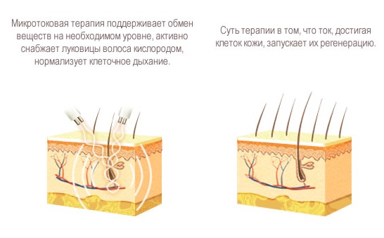 Lifting des seins sans implants. Procédures et méthodes d'élasticité des seins en cosmétologie