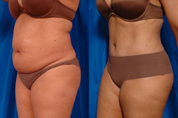 Forums de chirurgie plastique. Avis de chirurgiens, cliniques. Prix d'opération