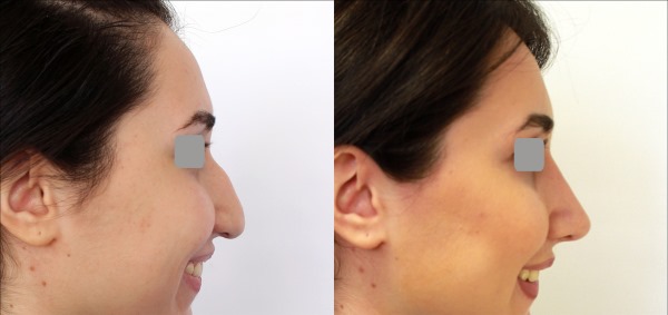 Forums de chirurgie plastique. Avis de chirurgiens, cliniques. Prix d'opération