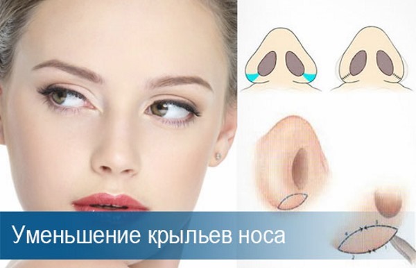 Rhinoplastie à Moscou. Prix et avis des cliniques dans la capitale