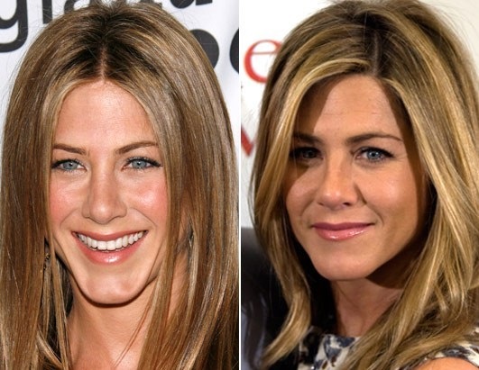 Jennifer Aniston. Photos avant et après la chirurgie plastique, en maillot de bain, paramètres de la figure, l'apparence de l'actrice