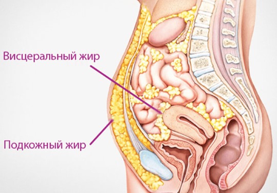 Comment enlever un gros ventre chez les femmes et les hommes. Causes et remèdes
