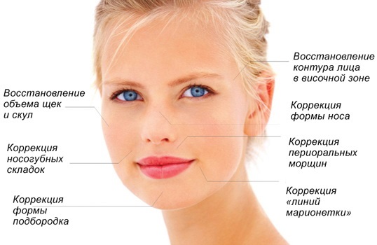 Radiesse en cosmétologie. Avis des cosmétologues, contre-indications, conséquences