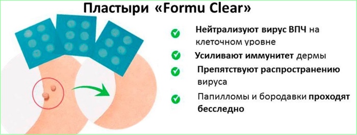 Papillomes sur le corps chez les femmes. Causes et traitement, comment se débarrasser des remèdes populaires