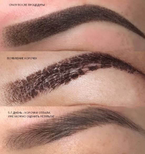 Maquillage permanent des sourcils, saupoudrage de poudre.Photos avant et après, combien de temps, guérison