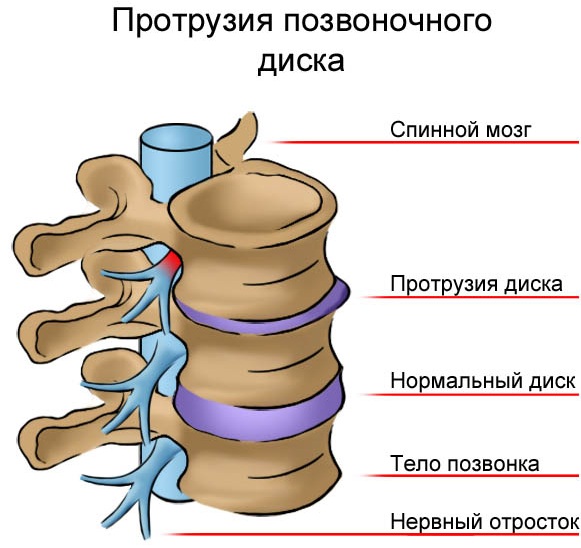 Bande élastique pour tirer sur la barre horizontale. Comment choisir, technique d'exercice pour les filles