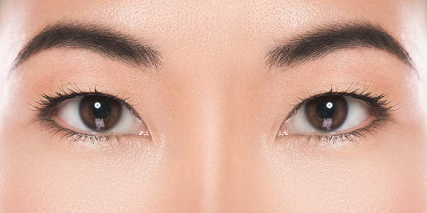Les filles ont de petits yeux. Comment augmenter le prix de la chirurgie plastique